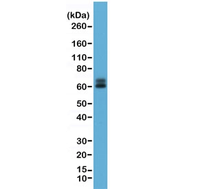 Western blot testing of human HeLa cell lysate with recombinant Paxillin antibody at 1:1000. Predicted molecular weight: 61/65/66 kDa (alpha/beta/gamma).