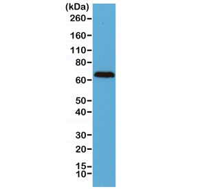 Western blot of human brain lysate using recombinant Neurofilament antibody at 1:2500. Predicted molecular weight: 62-68 kDa.