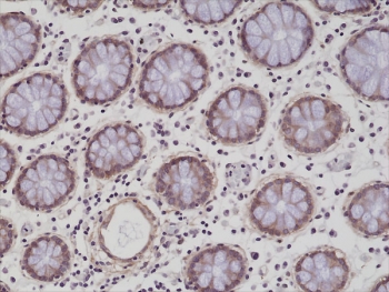 IHC testing of formalin fixed and paraffin embedded human colon tissue with recombinant ITGB1 antibody at 1:200 dilution. HIER: steam section in pH6 citrate buffer for 20 min and allow to cool prior to staining.