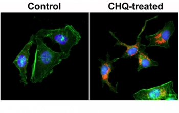 ICC staining of human HeLa cells untreated or treated with chloroquine (CHQ), with recombinant LC3B antibody (red) at 1:200 dilution. Actin filaments have been labeled with fluorescein phalloidin (green), and nucleus labeled with DAPI (blue).