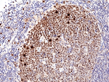 IHC testing of FFPE human tonsil tissue with recombinant Ki67 antibody. HIER: boil tissue sections in pH6, 10mM citrate buffer, for 10-20 min and allow to cool before testing.