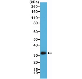Western blot testing of human A431 cell lysate with recombinant Calretinin antibody at 1:2000. Predicted molecular weight ~29 kDa.