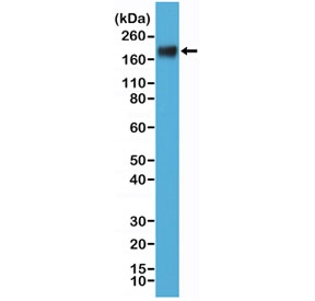 Western blot testing of human MCF7 cell lysate with recombinant CEA antibody at 1:000. Expected molecular weight: 80~200 kDa depending on glycosylation level.
