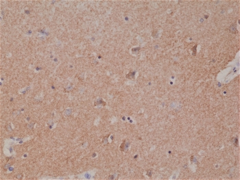 IHC staining of FFPE human brain tissue with recombinant Spastin antibody at 1:1000.