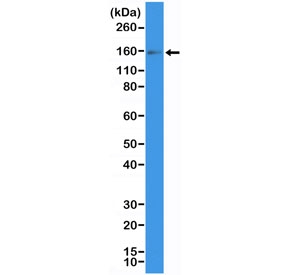 Western blot testing of human placental tissue with recombinant CD117 antibody at 1:200 dilution. Observed molecular weight: ~120/145 kDa (precusor/mature). Glycosylation may result in the protein being observed at higher molecular weights.