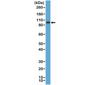 Western blot testing of human K562 cell lysate with recombinant SATB2 antibody at 1:1000 dilution. Predicted molecular weight ~83 kDa.