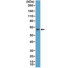 Western blot testing of human Jurkat cell lysate with recombinant TdT antibody at 1:2000 dilution. Predicted molecular weight: ~56 kDa.