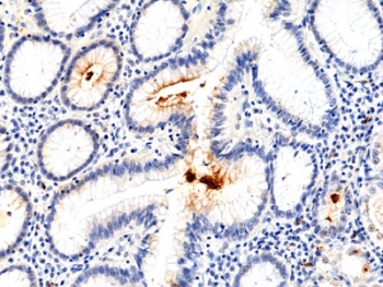IHC staining of FFPE human stomach tissue with recombinant Helicobacter pylori antibody at 1:100.