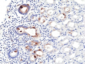 IHC staining of FFPE human stomach tissue with recombinant Helicobacter pylori antibody at 1:100.