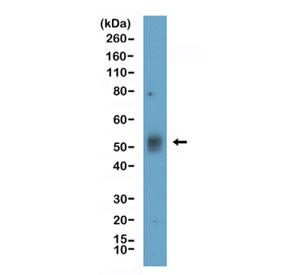 Western blot testing of human Daudi cell lysate with recombinant TIM-3 antibody at 1:1000. Expected molecular weight: 33-70 kDa depending on glycosylation level.