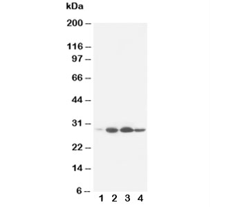 Western blot testing of Bcl-2 antibody and rat tissue: 1. heart;  2. spleen;  3. small intestine;  4: liver. Predicted molecular weight ~26 kDa.