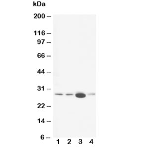 Western blot testing of Calbindin antibody and Lane 1:  rat brain;  2: rat brain;  3: rat kidney;  4: rat lung tissue lysate. Expected molecular weight: 27-28 kDa.