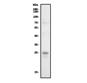 Western blot testing of human A549 cell lysate with Cathepsin L antibody. Expected molecular weight: 38-41 kDa with multiple smaller processed/active forms.