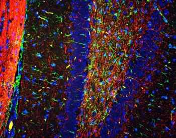 Immunofluorescent staining of FFPE rat brain tissue with GFAP antibody (green), MBP antibody (red) and DAPI nuclear stain (blue). HIER: steam section in pH6 citrate buffer for 20 min.