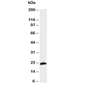 Western blot testing of Myosin antibody and rat skeletal muscle tissue lysate