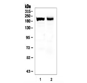 Western blot testing of 1) mouse skeletal muscle and 2) rat skeletal muscle tissue lysate with Myosin antibody.