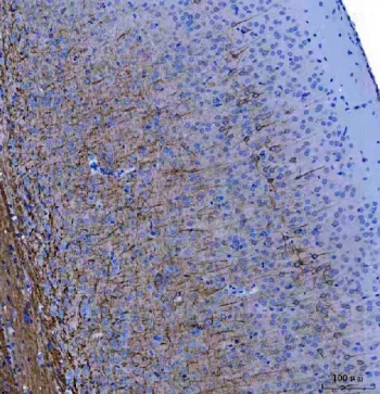 IHC staining of FFPE mouse brain tissue with Light Chain Neurofilament antibody. HIER: boil tissue sections in pH8 EDTA for 20 min and allow to cool before testing.