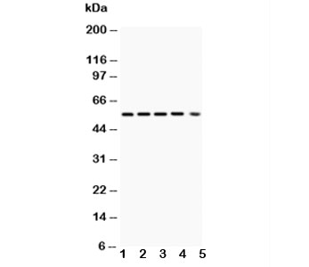 Western blot testing of Akt1 antibody and Lane 1:  rat ovary;  2: (r) PC-12;  3: human A549;  4: (h) MCF-7;  5: mouse HEPA lysate;  Predicted size: 56 kDa;  Observed size: 56 kDa.