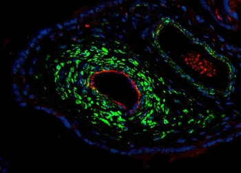 Immunofluorescent staining of FFPE human placental tissue with ACTA2 antibody (green), CD31 antibody (red) and DAPI nuclear stain (blue). HIER: steam section in pH8 EDTA buffer for 20 min.