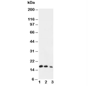 Western blot testing of IL7 antibody and Lane 1:  Recombinant human IL-7 protein 10ng;  2: 5ng;  3: 2.5ng
