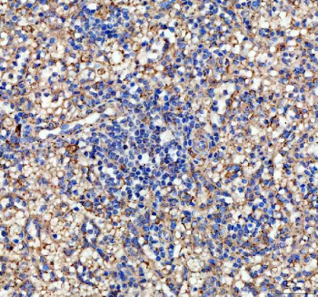 IHC staining of FFPE human spleen tissue with human IL-10 antibody, HRP-labeled secondary and DAB substrate. HIER: boil tissue sections in pH8 EDTA for 20 min and allow to cool before testing.