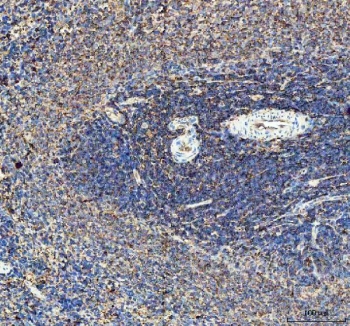 IHC staining of FFPE rat spleen tissue with Il10 antibody. HIER: boil tissue sections in pH8 EDTA for 20 min and allow to cool before testing.