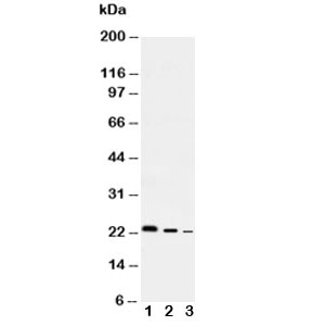 Western blot testing of Il10 antibody and Lane 1:  Recombinant rat protein 10ng;  2: 5ng;  3: 2.5ng
