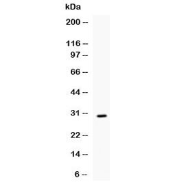 Western blot testing of recombinant mouse IL17 protein (0.5ng/lane) + tag with IL17 antibody at 0.5ug/ml. Predicted molecular weight of native protein: 15-20 kDa (monomer), 30-40 kDa (homodimer), depending on glycosylation level.