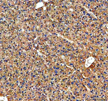 IHC staining of FFPE mouse liver tissue with Transferrin antibody. HIER: boil tissue sections in pH8 EDTA for 20 min and allow to cool before testing.