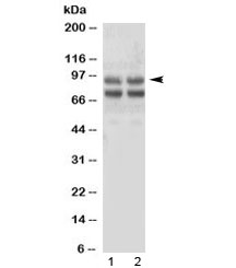 Western blot testing of human 1) SMMC-7721 and 2) HepG2 cell lysate with Angiostatin K1-3 antibody. Expected molecular weight of Plasminogen: 90-95 kDa.