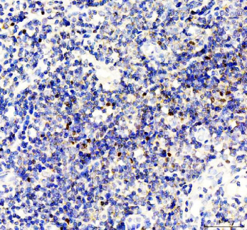 IHC staining of FFPE human tonsil tissue with FOXP3 antibody, HRP-labeled secondary and DAB substrate. HIER: boil tissue sections in pH8 EDTA for 20 min and allow to cool before testing.