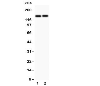 Western blot testing of Collagen III antibody and human cell lysates 1) MCF-4 and 2) COLO320. Predicted molecular weight ~139 kDa.