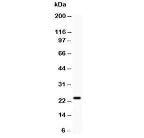 Western blot testing of Claudin-5 antibody and rat liver. Predicted molecular weight ~23 kDa.