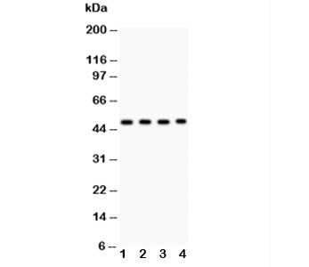 Western blot testing of MBD2 antibody and Lane 1:  SGC;  2: HeLa;  3: Jurkat;  4: K562;  Predicted/observed molecular weight: ~47kDa.