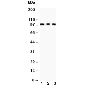 Western blot testing of CD146 antibody and Lane 1:  A375;  2: HeLa;  3: HEPG2.  The glycoprotein is routinely visualized between 70~120KD.