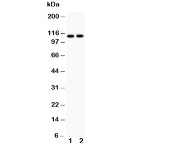 Western blot testing of ATP2A3 antibody and Lane 1:  rat skeletal muscle;  2: mouse skeletal muscle;  Predicted size: 114KD;  Observed size: 114KD