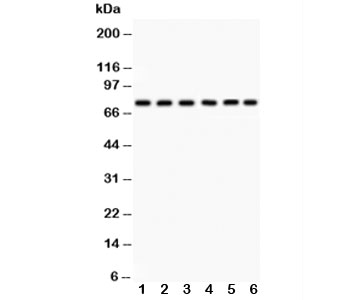 Western blot testing of PKC delta antibody and Lane 1:  HeLa;  2: SMMC-7721;  3: U87;  4: Jurkat;  5: CEM;  6: A549;  Predicted size: 77KD;  Observed size: 77KD