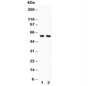 Western blot testing of Alkaline Phosphatase antibody and Lane 1:  rat heart;  2: rat brain.  Predicted molecular weight ~57 kDa, but can be observed at up to ~75 kDa due to glycosylation.