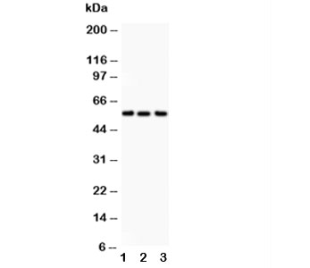 Western blot testing of Alkaline Phosphatase antibody and Lane 1:  human placenta;  2: HT1080;  3: Jurkat.  Predicted molecular weight ~57 kDa, but can be observed at up to ~75 kDa due to glycosylation.