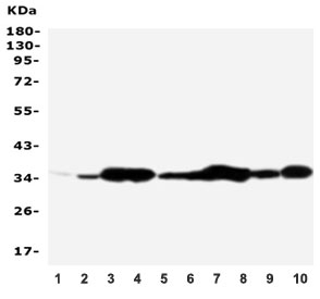 Western blot testing of Annexin V antibody and Lane 1:  rat brain;  2: rat skeletal muscle;  3: rat ovary;  4: rat lung;  5: MCF-7;  6: SMMC-7721;  7: A549;  8: Jurkat;  9: SGC;  10: HT1080;  Predicted molecular weight ~36 kDa.