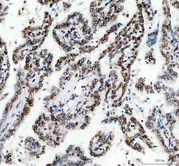 Immunofluorescent staining of FFPE human SiHa cells with Lamin B1 antibody (red) and Beta Tubulin antibody (green). HIER: steam section in pH6 citrate buffer for 20 min.