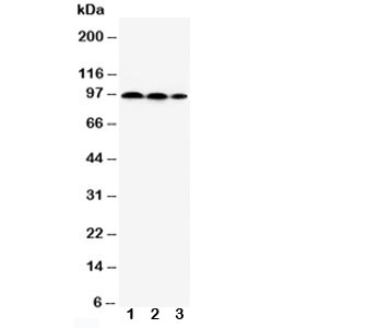 Western blot testing of HIF2a antibody and Lane 1:  HeLa;  2: MCF-7;  3: Jurkat cell lysate