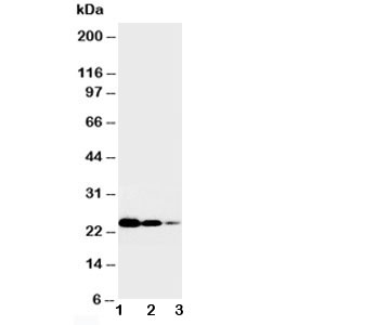 Western blot testing of TNFR1 antibody and Lane 1:  Recombinant human TNFR1 protein 10ng;  2: 5ng;  3: 2.5ng