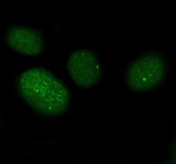 Immunofluorescent staining of FFPE human U-2 OS cells with XAF1 antibody. HIER: steam section in pH6 citrate buffer for 20 min.