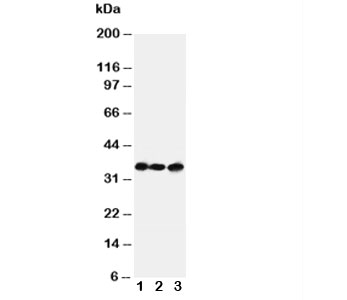 Western blot testing of AQP4 antibody and Lane 1:  rat heart;  2: rat brain;  3: human COLO320 cell lysate. Observed molecular weight: 35~45kDa depending on glycosylation level.