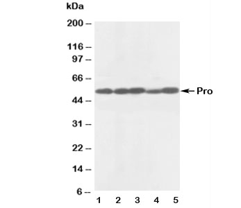 Western blot testing of anti-Caspase-8 antibody and Lane 1:  rat thymus;  2: rat liver;  3: human MCF-7;  4: (h) HeLa;  5: (h) SMMC-7721 lysate. Predicted molecular weight: ~55 kDa (pro), ~40 kDa (large + small subunit), ~20 kDa (large subunit).