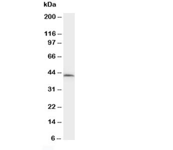 Western blot testing of NPHS2 antibody and rat kidney tissue lysate.  Predicted molecular weight ~42kDa.