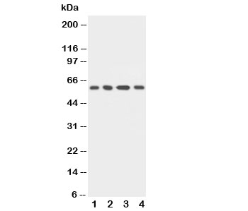 Western blot testing of uPAR antibody and human samples: 1) MCF-7, 2) HeLa, 3) Raji and 4) SMMC-7721 cell lysate. Predicted molecular weight: 37-60 kDa, depending on glycosylation level.