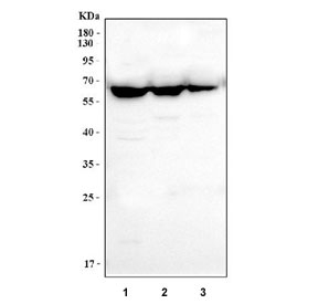 Western blot testing of human 1) Raji, 2) Daudi and 3) Ramos cell lysate with CD80 antibody. Expected molecular weight: 34-75 kDa depending on the level of glycosylation.