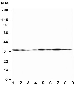 Western blot testing of Connexin 32 antibody and Lane 1:  rat heart;  2: (r) heart;  3: (r) skeletal muscle;  4: (r) brain;  5: human MCF-7;  6: (h) HeLa;  7: (h) SMMC-7721;  8: (h) Jurkat;  9: (h) COLO320 lysate. Predicted molecular weight ~32 kDa.